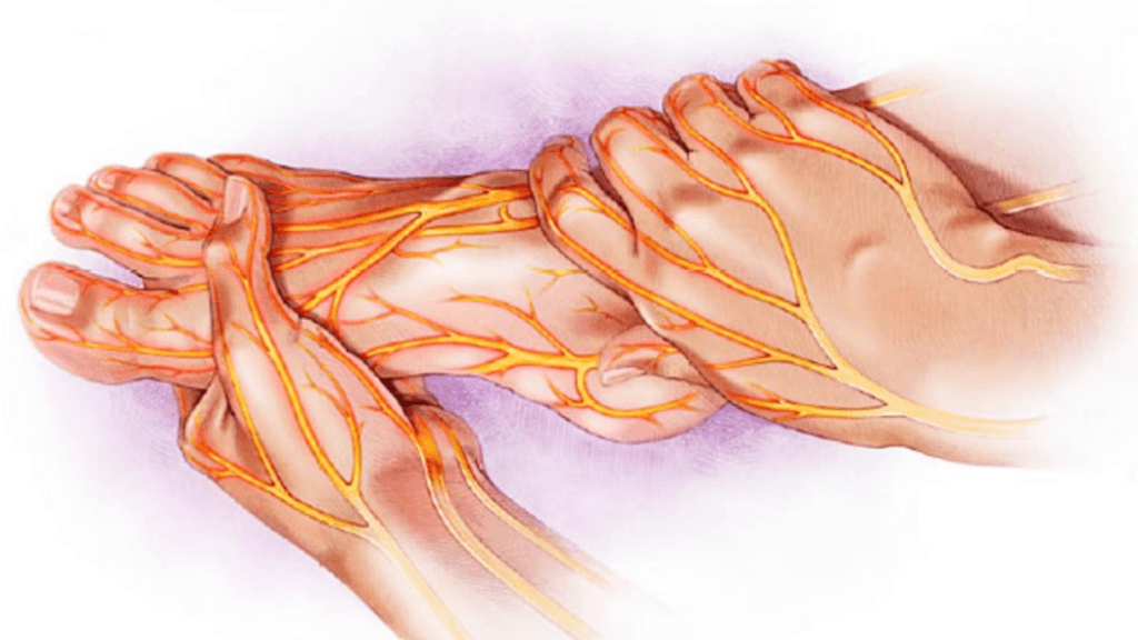 Ce este neuropatia periferica