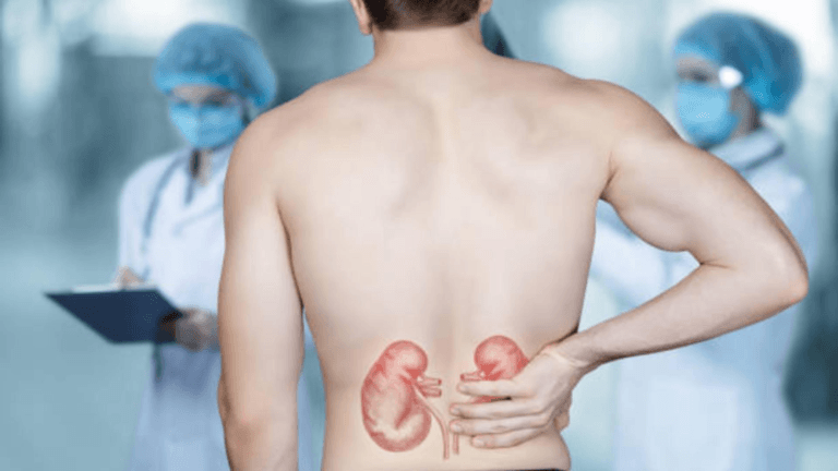 Cum sa previi pietrele la rinichi Recomandari utile