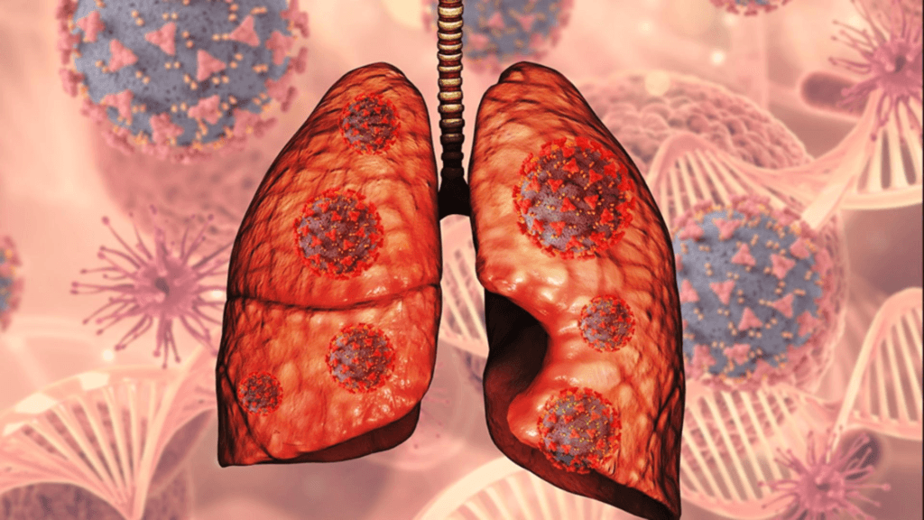 Boala incurabila tuse persistenta si mucus gros