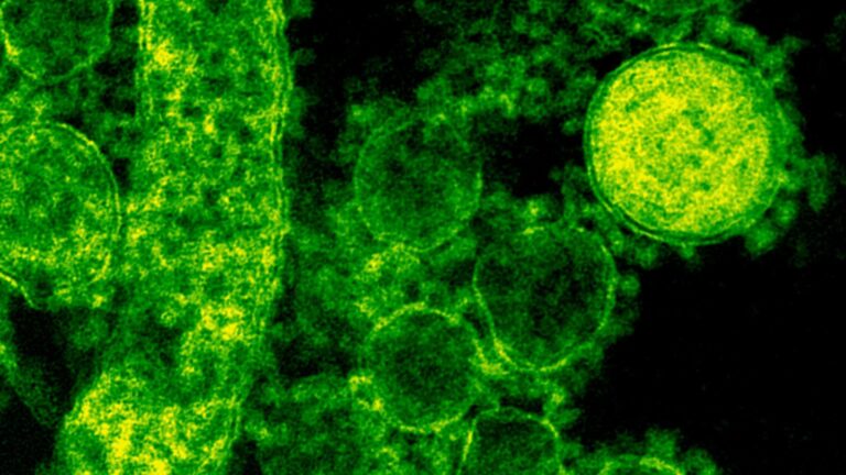 Cat de contagioasa este lepra spun specialistii