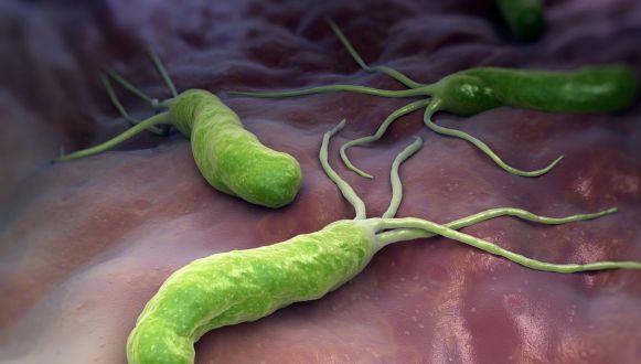 Helicobacter pylori, bacteria frecventă care afectează stomacul Helicobacter pylori bacteria frecventa care afecteaza stomacul