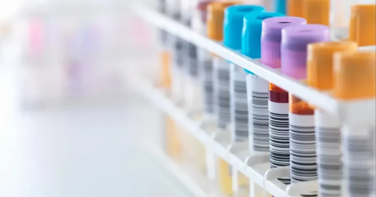 România, fruntașă în UE la HIV depistat târziu. 60% din cazuri, în stadii avansate