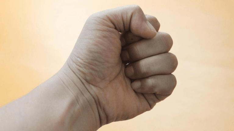 ce sa faci daca ai o fractura de pumn